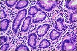 cross section of intestinal glands